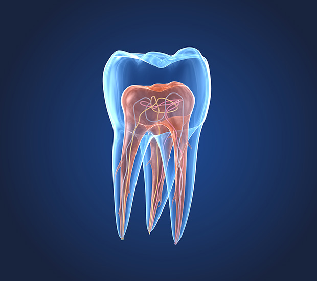 Jacksonville What is an Endodontist